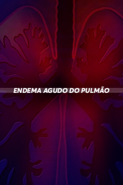 Edema Agudo do Pulmão